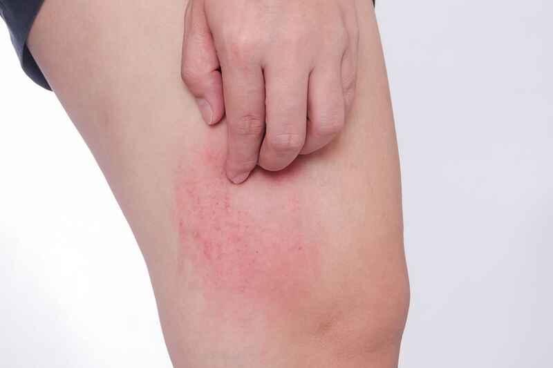 Độ ẩm 80 3