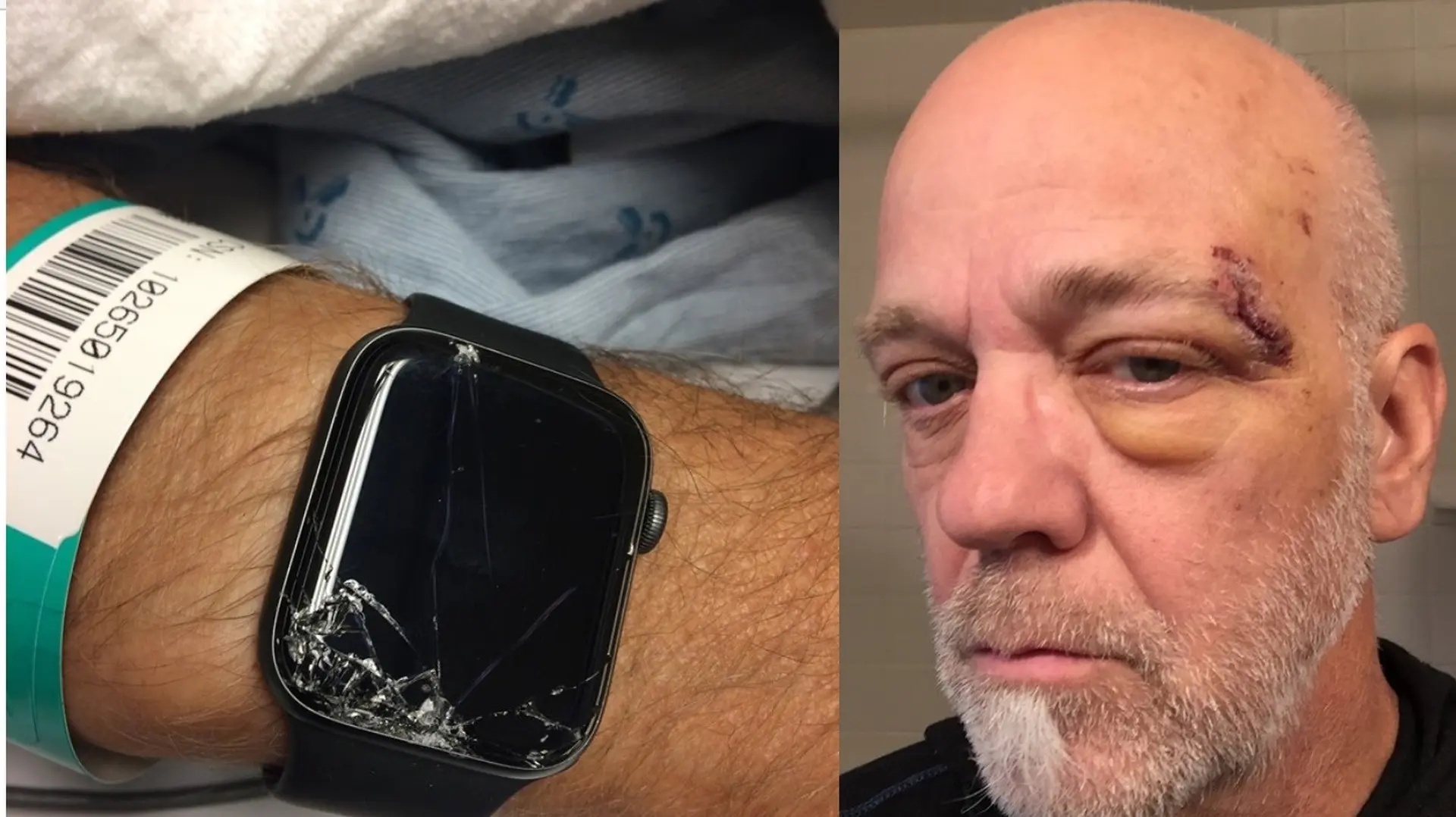 Apple Watch Series 4 cứu sống một người đi xe đạp leo núi