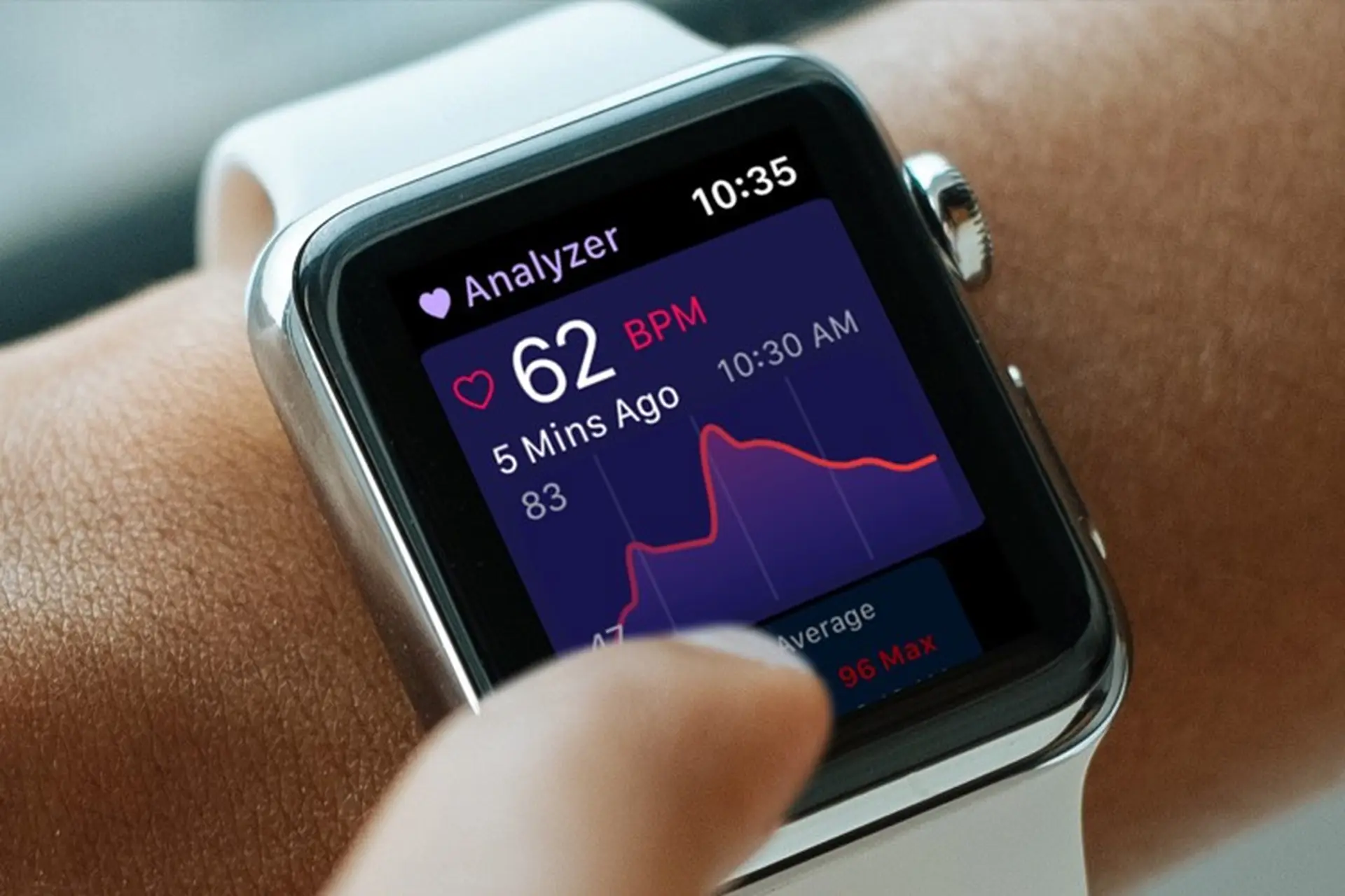 Apple Watch: ứng dụng Heart Analyzer bổ sung giao diện và Dark Mode mới