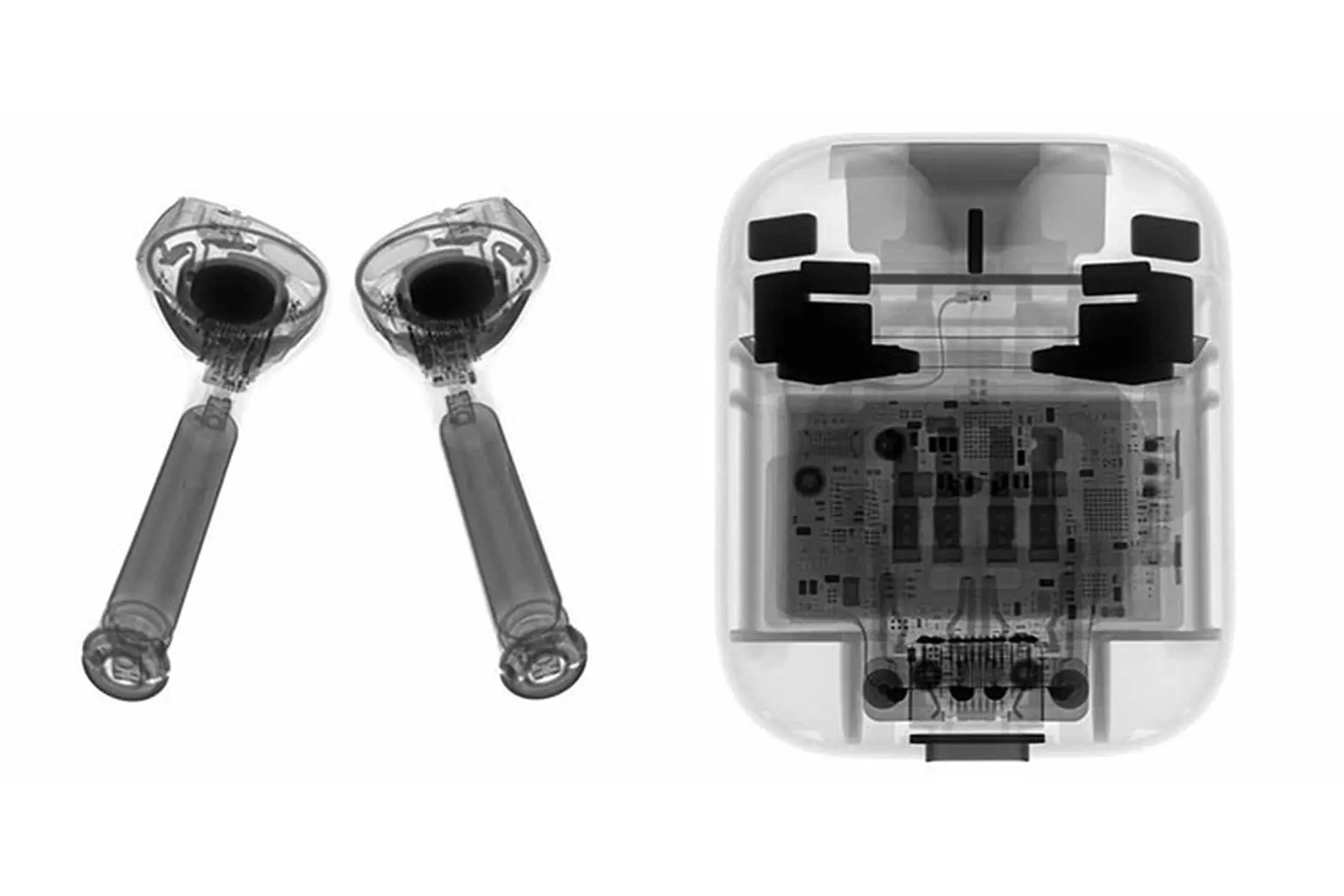 Thêm một người đàn ông vô tình nuốt AirPod trong khi ngủ