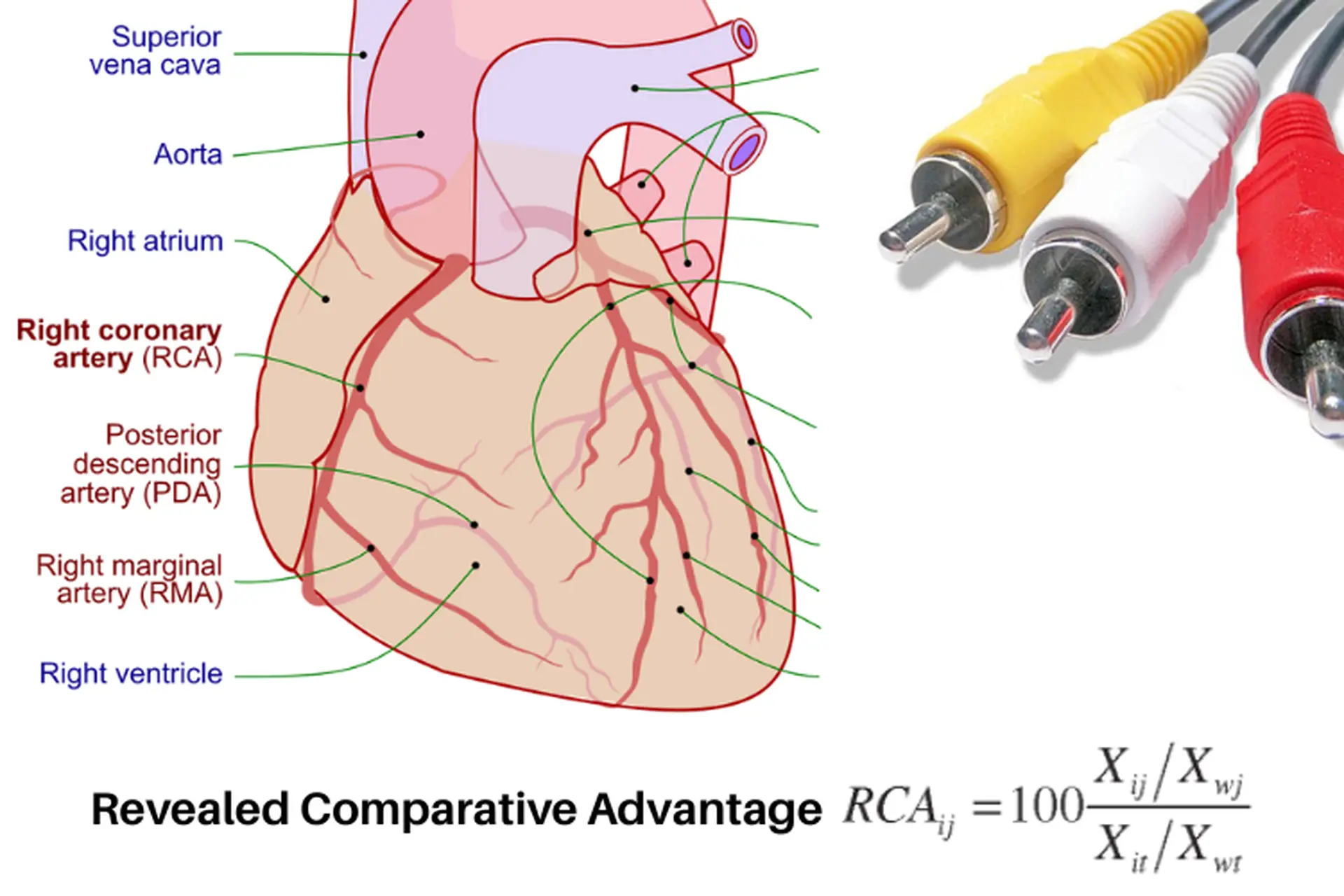 RCA là gì? Phân biệt ý nghĩa của thuật ngữ RCA trong kinh tế, công nghệ và y học