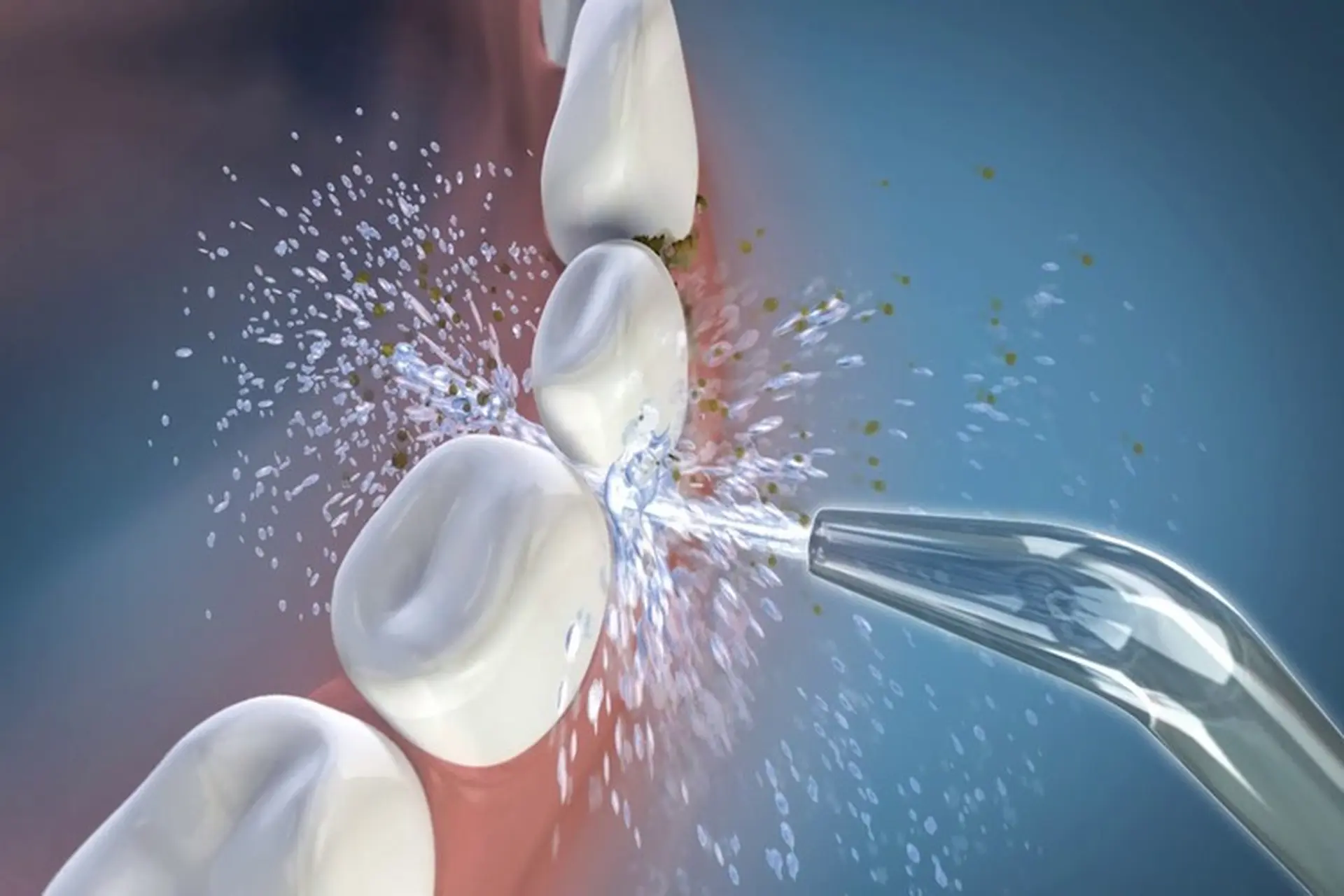 Tăm nước Oral B có tốt không? Top 3 mẫu tăm nước Oral B được ưa chuộng hiện nay