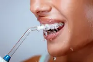 Bật mí cách chọn máy tăm nước cho người niềng răng an toàn và bảo vệ nướu tối ưu