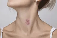 Tất tần tật về dấu hickey: Top thắc mắc thường gặp và cách xử lý an toàn, tế nhị bạn nên biết
