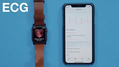 Trải nghiệm tính năng đo điện tâm đồ ECG trên Apple Watch Series 4