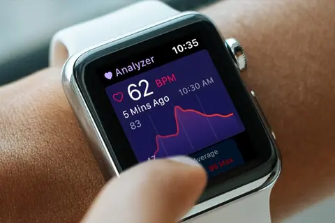 Apple Watch: ứng dụng Heart Analyzer bổ sung giao diện và Dark Mode mới