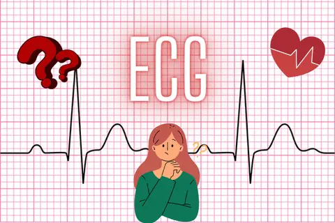 ECG là gì? ECG dùng để làm gì? Có thể sử dụng trên thiết bị nào? 