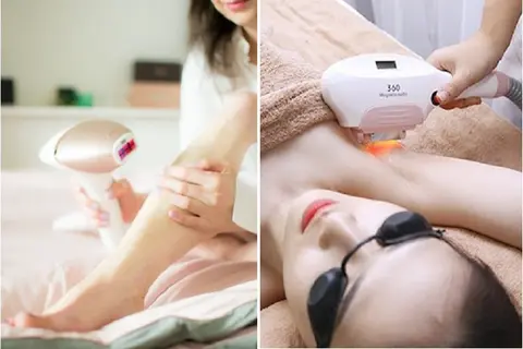 Nên mua máy triệt lông hay đi spa? Phương pháp làm đẹp nào tốt nhất cho bạn?
