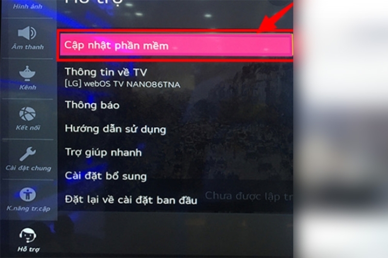 Tivi LG bị sọc màn hình (5)