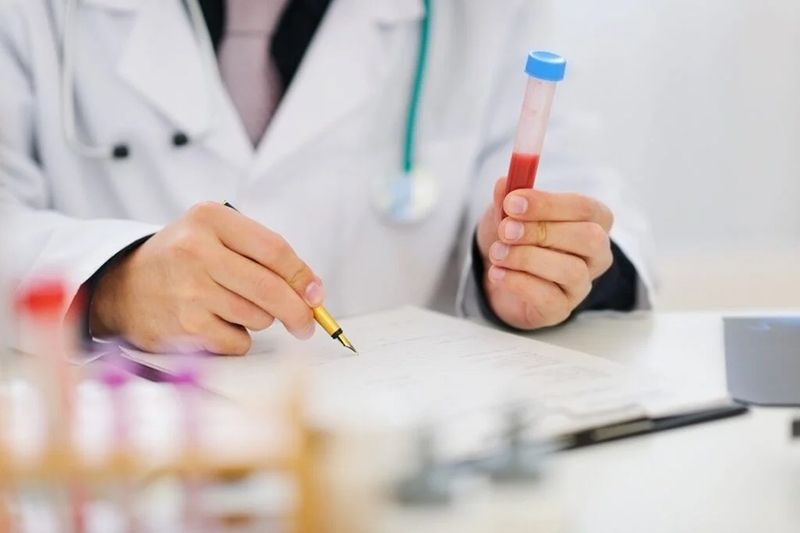 Quá trình chuẩn bị cho xét nghiệm triglyceride cũng rất quan trọng