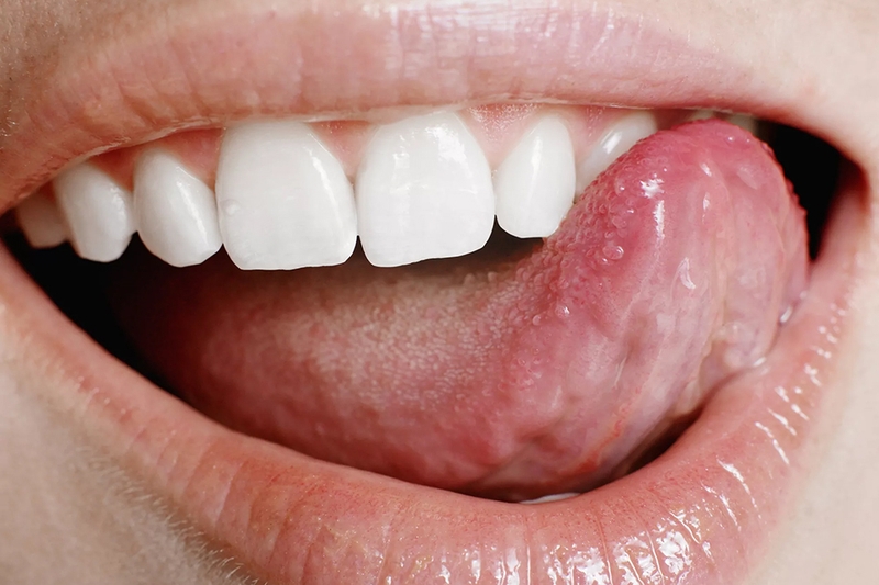 tại sao ăn dứa lại rát lưỡi ở nhiều người