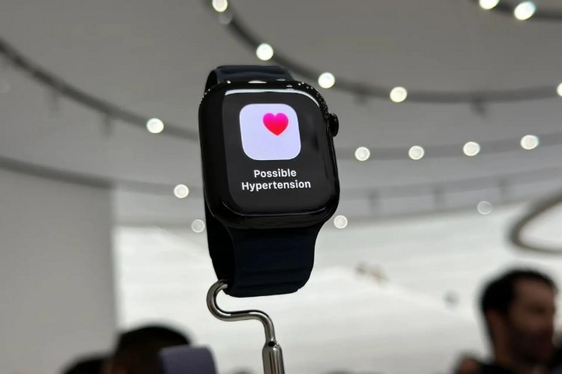 apple watch có đo đường huyết không ảnh 2