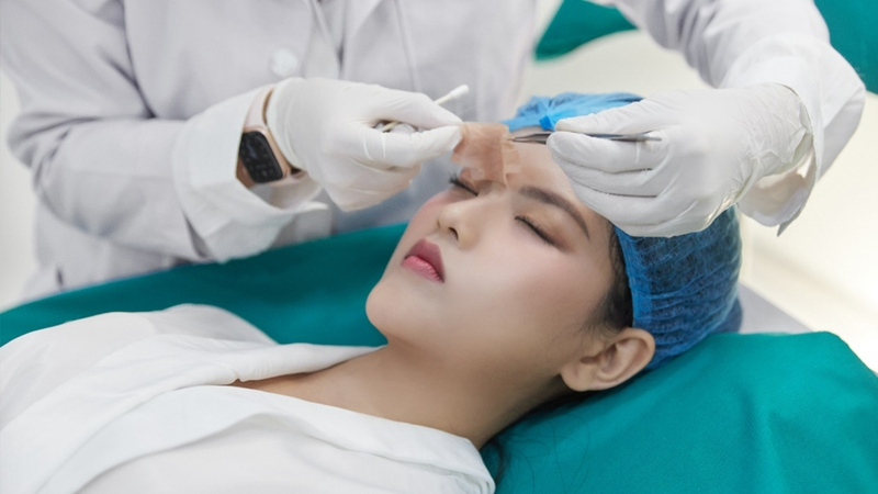 BHYT không chi trả phí dịch vụ thẩm mỹ