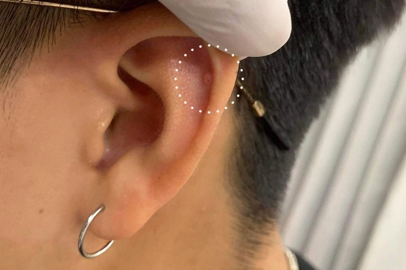 bump là gì ảnh 1