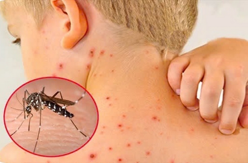 cách đuổi muỗi trong phòng ảnh 2