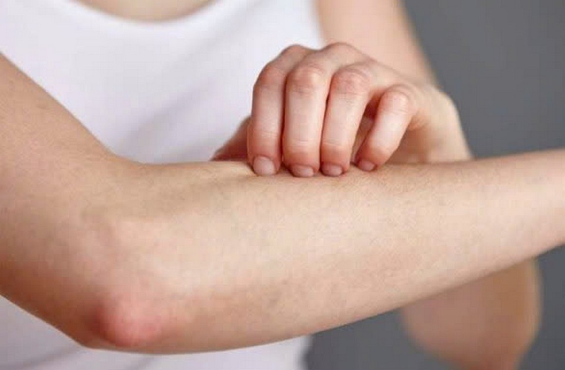 Cúc họa mi ảnh 7