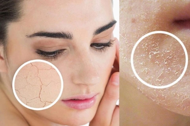 Khô da khi bật đèn quá lâu