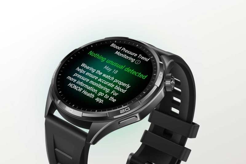 HONOR Watch 6 tích hợp tính năng theo dõi xu hướng huyết áp, giúp người dùng tham khảo sự thay đổi của chỉ số theo thời gian.