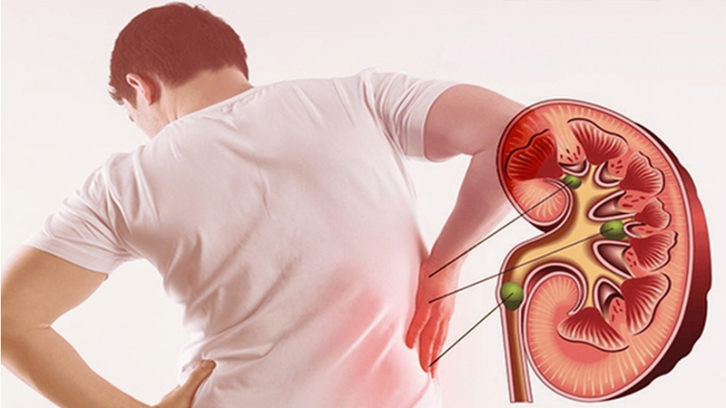 Người có bệnh về thận nên hạn chế ăn khoai lang trắng
