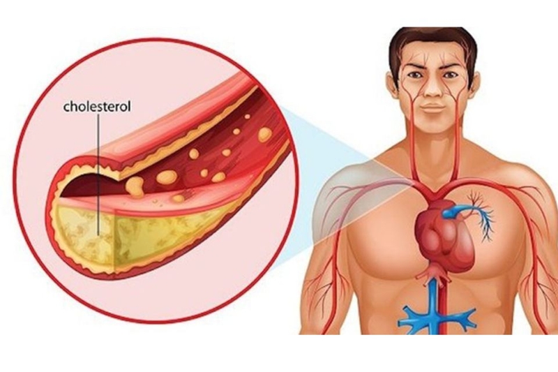 Giảm mức cholesterol