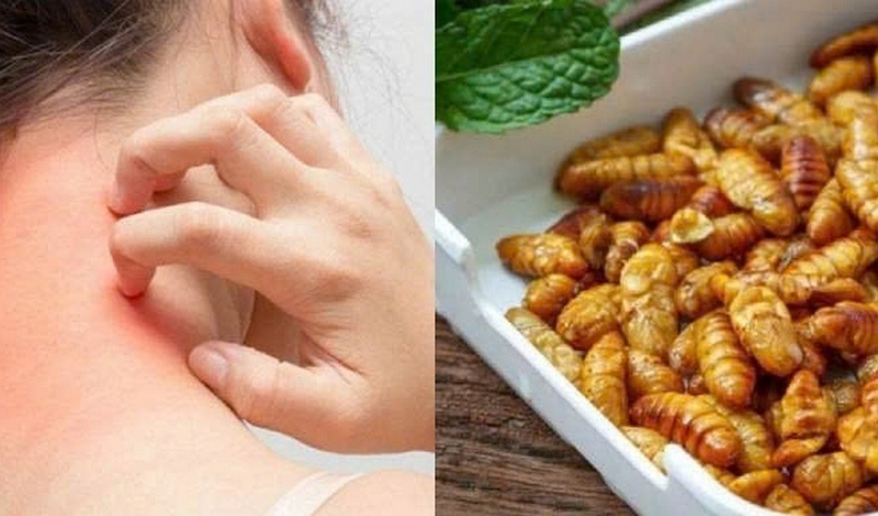 rang nhộng tằm tránh dị ứng ảnh 2