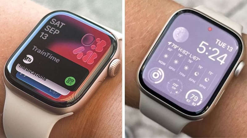So sánh Apple Watch Series 11 và Series 9 3