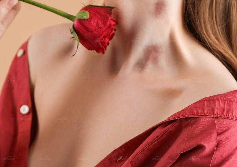 dấu hickey (hình 5)