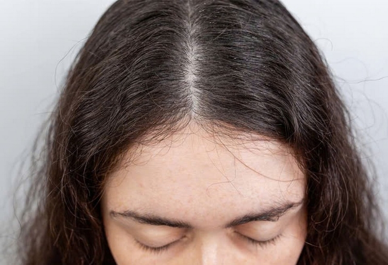 tóc mullet layer nữ ảnh 9