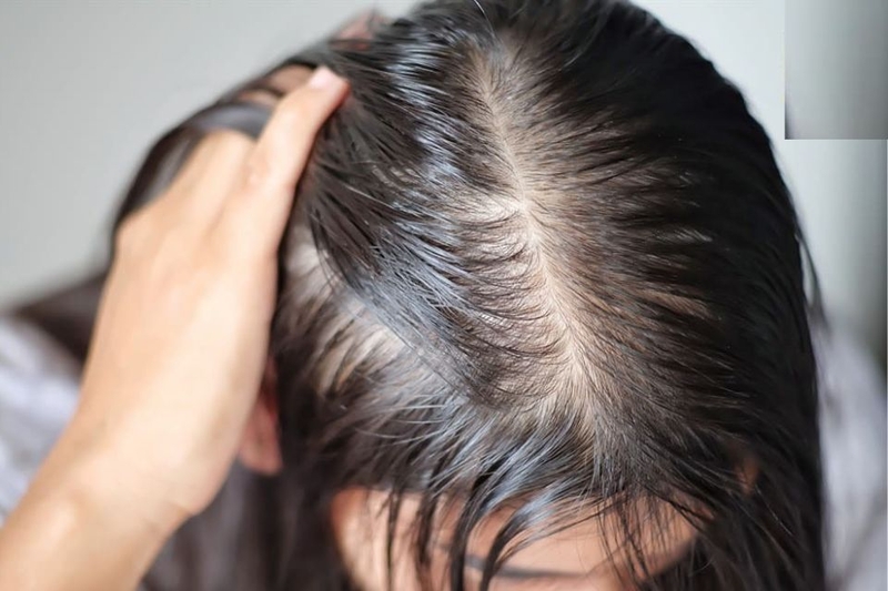 Tóc ngắn layer mỏng