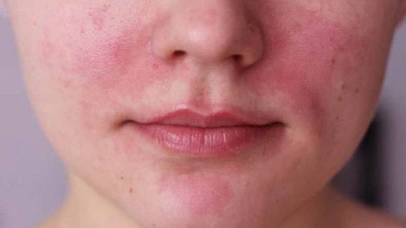 Trời mưa độ ẩm cao hay thấp? 4