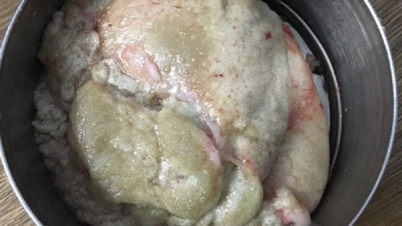Bước 1: Rửa trứng cá