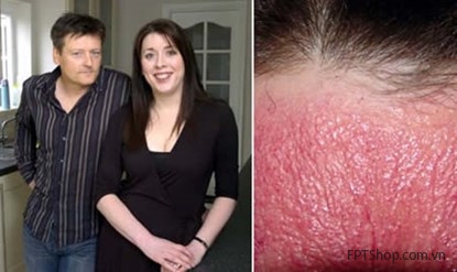 các thiết bị không dây có khả năng sẽ gây ra bệnh ung thư