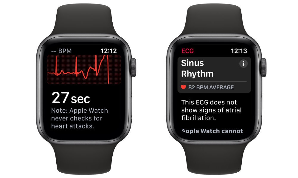 đo điện tâm đồ trên Apple Watch series 5