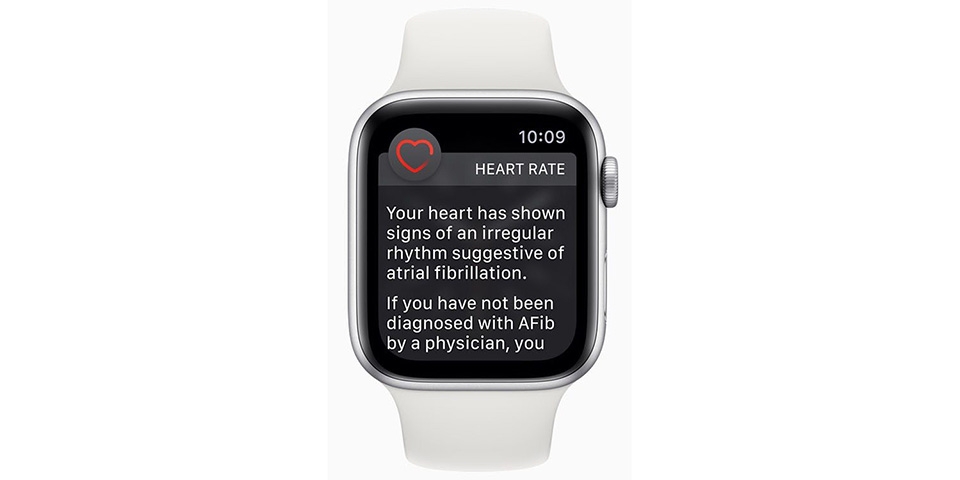 Apple Watch không thể phát hiện AFib ở nhịp tim trên 120bpm Apple Watch không thể phát hiện AFib ở nhịp tim trên 120bpm