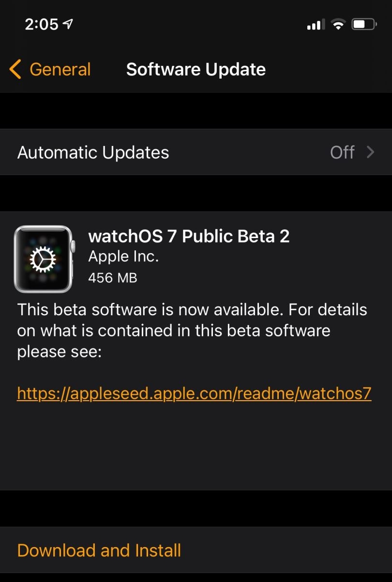 cập nhật watchOS 7