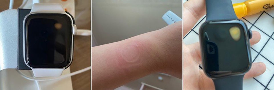 Apple Watch SE gặp lỗi quá nhiệt (ảnh 1)