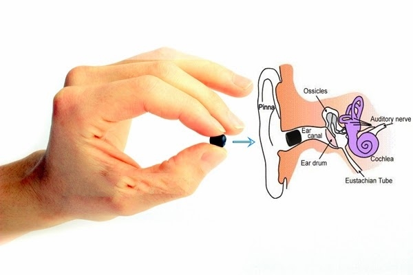 Tai nghe siêu nhỏ là gì?