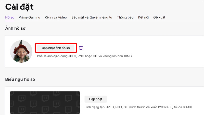 Click chuột vào Cập nhật ảnh hồ sơ