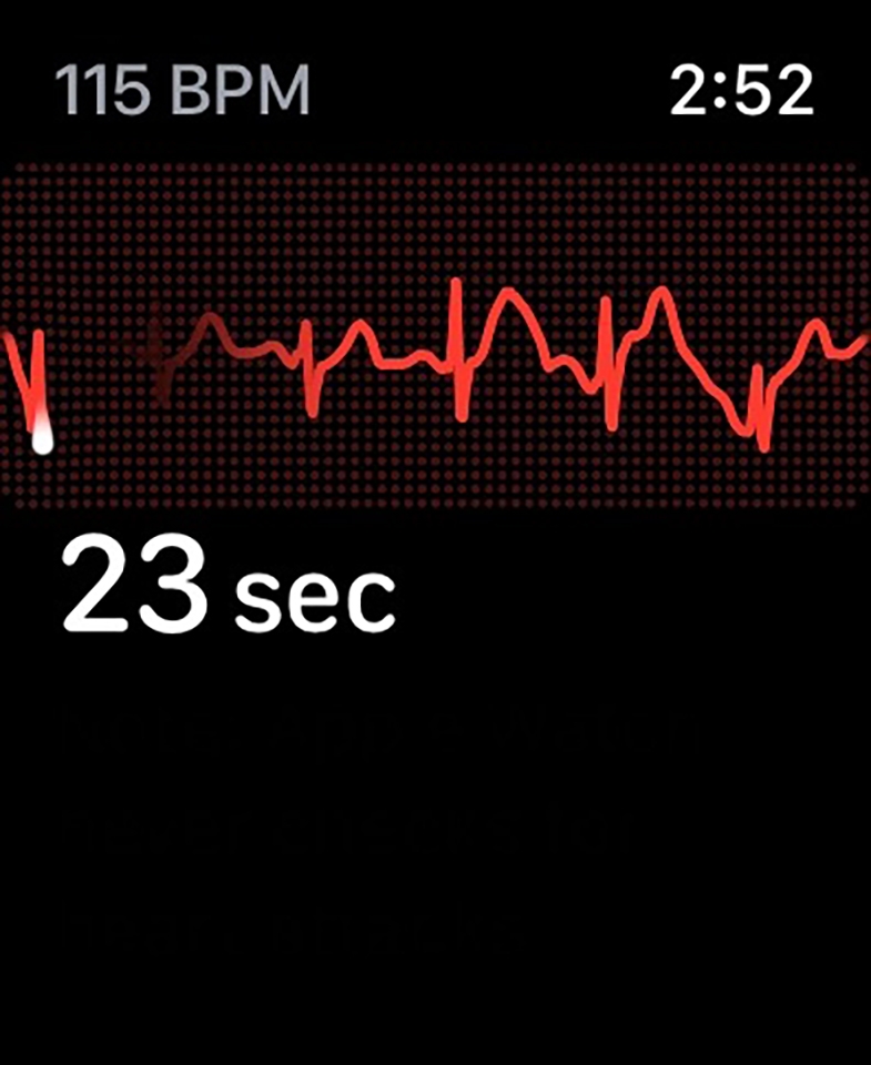 Tính năng Apple Watch series 8 (ảnh 4)