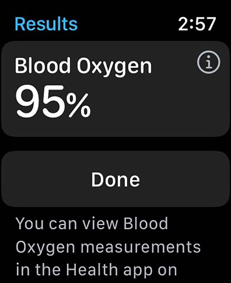 Tính năng Apple Watch series 8 (ảnh 5)