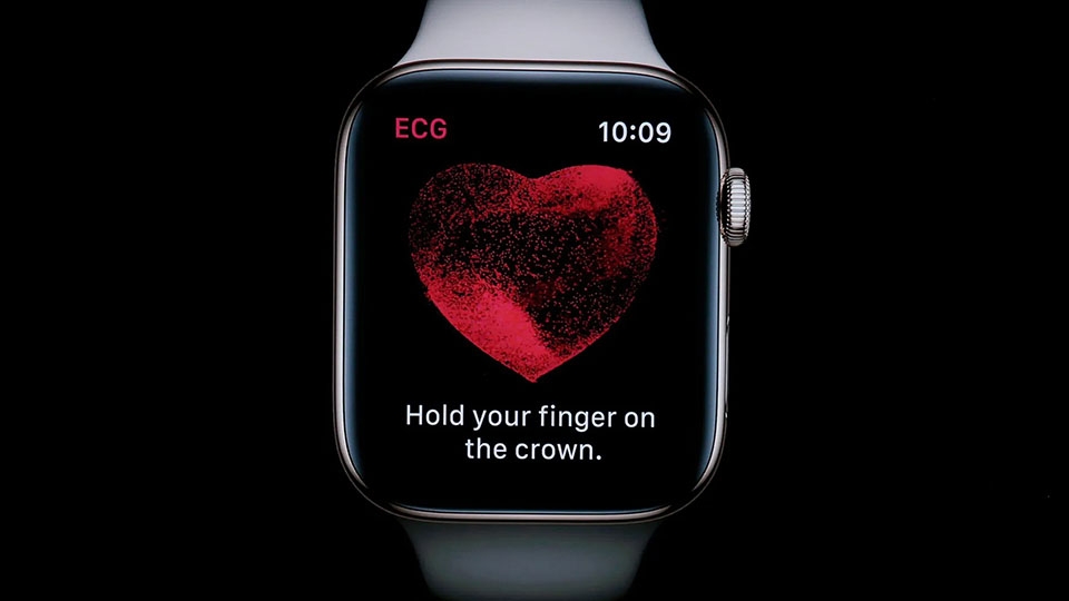Apple Watch có thể phát hiện một bệnh tim mới, có thể đe dọa đến tính mạng