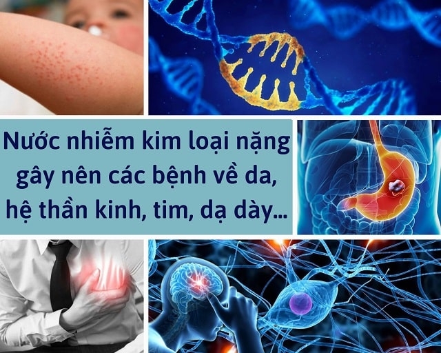 Tác hại của kim loại nặng là gì?