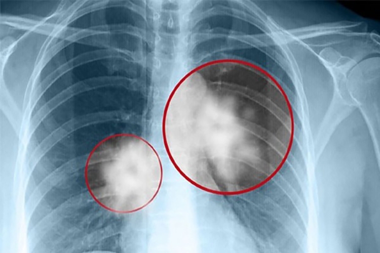 Amiang là gì (Hình 2)