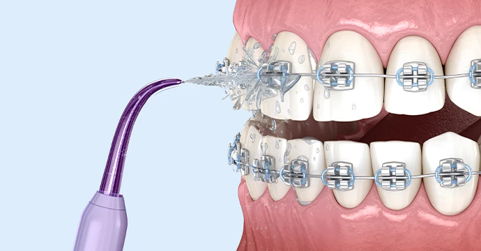 Tăm nước 4