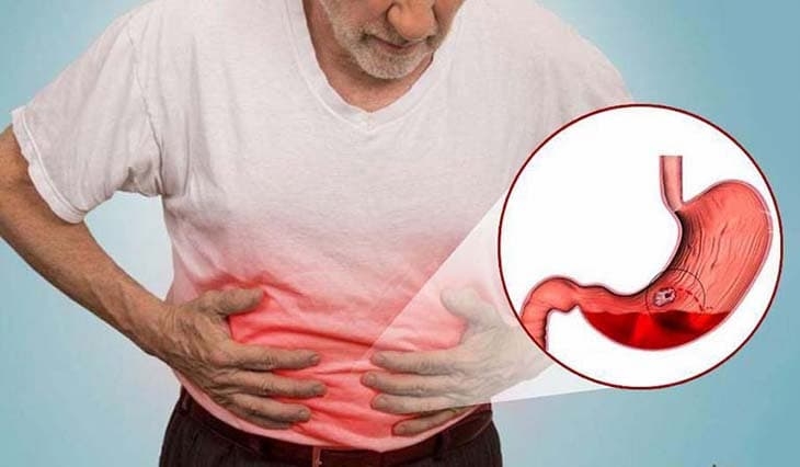 Dưa gang bao nhiêu calo? Ăn dưa gang có giảm cân hay không? Hình 7