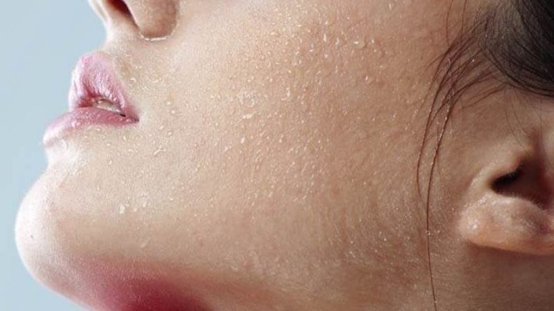 Da dẻ khô nứt khi độ ẩm xuống thấp