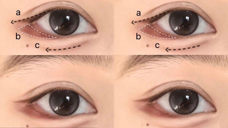 Mở góc và tạo bọng mắt