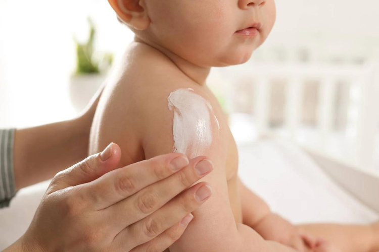 Nên bôi thêm kem dưỡng ẩm cho trẻ để tránh khô da
