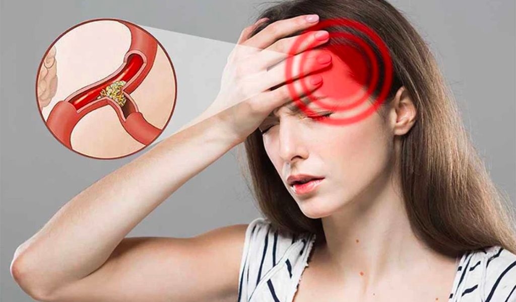 Trà đào bao nhiêu calo? Hướng dẫn cách làm trà đào giảm cân hiệu quả và an toàn 4