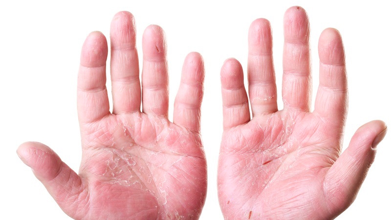 Slime là gì? Phụ huynh cần lưu ý những gì khi cho trẻ chơi Slime để đảm bảo an toàn? 3